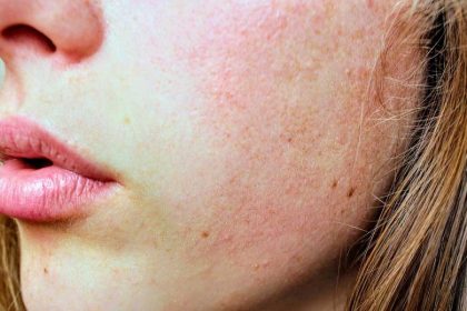 Obtenir une belle peau de façon naturelle