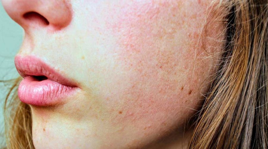 Obtenir une belle peau de façon naturelle