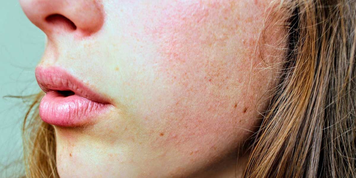 Obtenir une belle peau de façon naturelle : ce que vous devez savoir