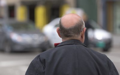 La greffe capillaire pour retrouver une belle chevelure