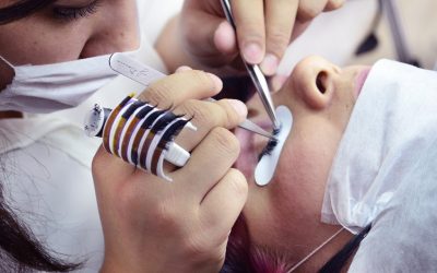 Quels sont les avantages de l’épilation laser ?