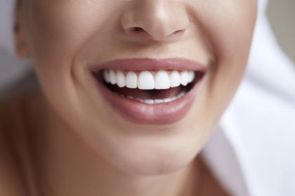 dentisterie esthétique