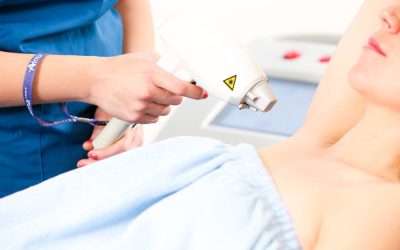 L’épilation au laser : combien cela coûte ?