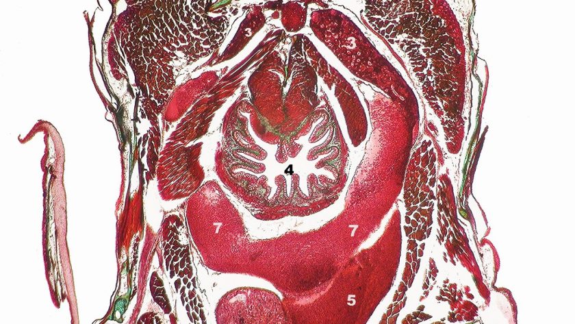 cancer oesophage