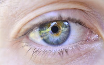 Pourquoi opter pour la technique de prelex ?