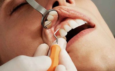 Que faire en cas de maladies bucco-dentaires ?