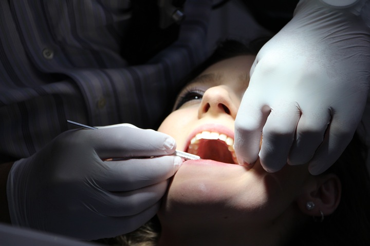 Limes endodontiques manuelles - pxhere.com
