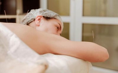Acupuncture pour vaincre l&rsquo;insomnie : combien de séances ?