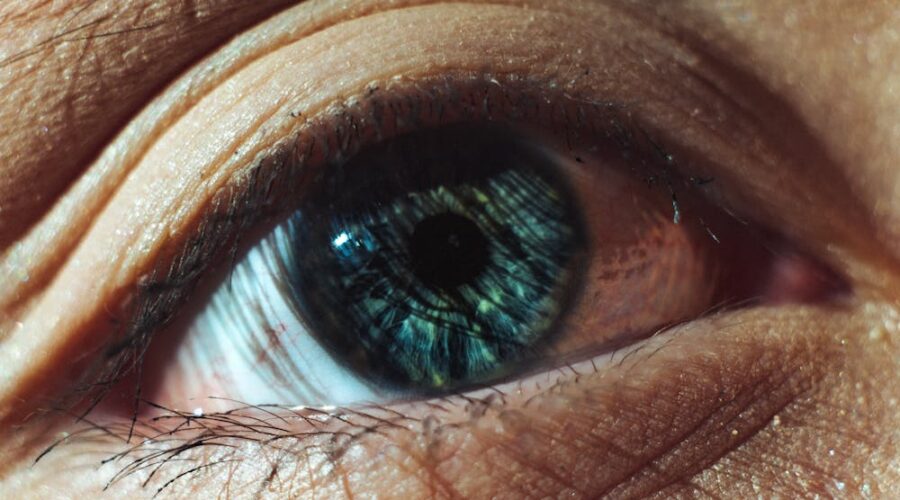 Lentilles intraoculaires