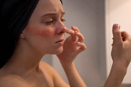 Consultation dermatologique problème cutanés